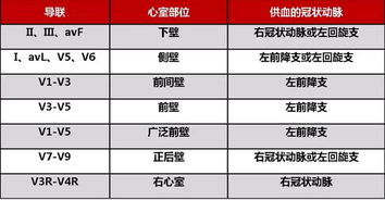 什么是VPS,VPS怎么用?