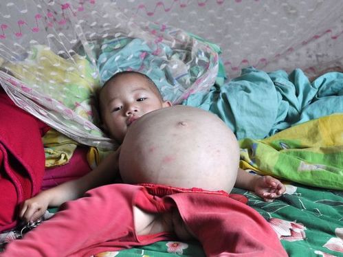 正常女孩腹中线图片，正常女生腹中线图片