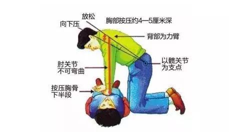 心肺复苏法，心肺复苏法支持生命的三项基本措施是什么