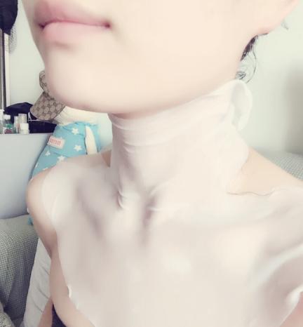 脖子上有草莓印怎么快速消除，怎么尽快消除脖子上的草莓印