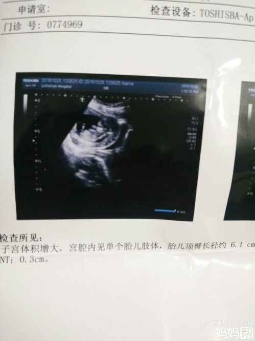 胎梦是什么意思