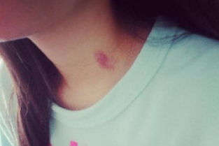 怎么种草莓在脖子上，怎么种草莓在脖子上视频教程