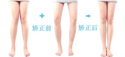 腿图片，腿图片简笔画