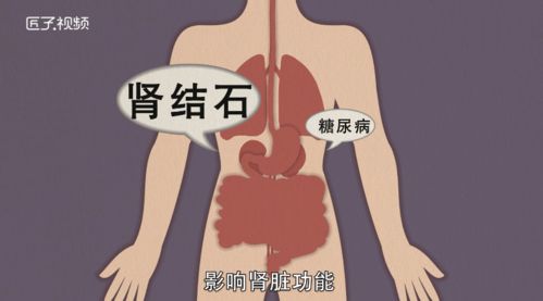 梦见洗头是什么预兆，梦见洗头是什么预兆女人