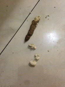 拉白屎是怎么回事，小孩拉白屎是怎么回事