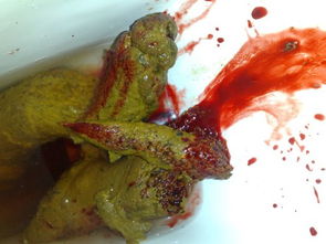 拉屎的时候拉出血，拉屎的时候拉出血怎么办