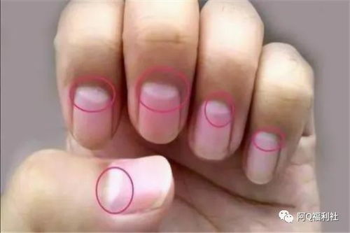 指甲月牙代表什么，指甲月牙代表什么器官