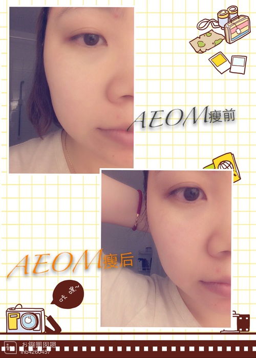 脸部遇热就发红怎么办，脸部遇热就发红怎么办小妙招