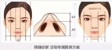 缩小鼻翼的方法有什么?