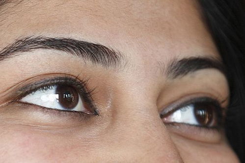 眉毛长，眉毛长痘痘的原因