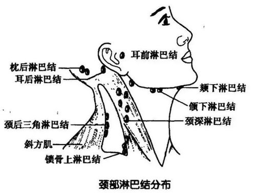 淋巴结在脖子哪个部位，淋巴结在脖子哪个部位图解