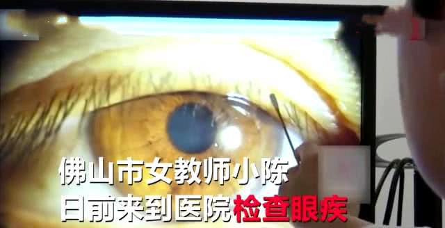 眼缘炎，眼缘炎是由什么引起的