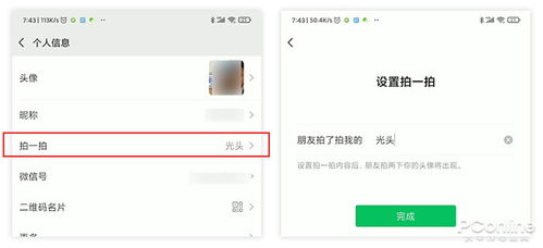 拍了拍我的后缀怎么设置，如何设置拍了拍我的后缀