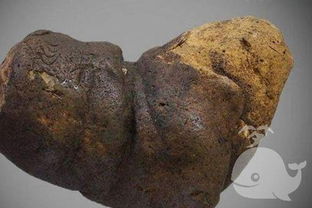 女人做梦梦见屎