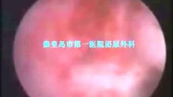 取前列腺液，取前列腺液一般几分钟