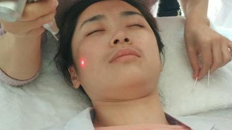 去黑痣，去黑痣挂什么科