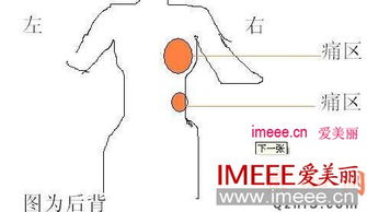 后背疼痛分布图