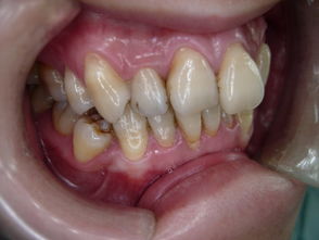 人的牙齿分别叫什么齿?