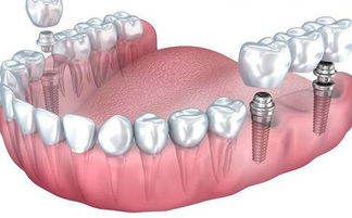牙齿生长顺序图
