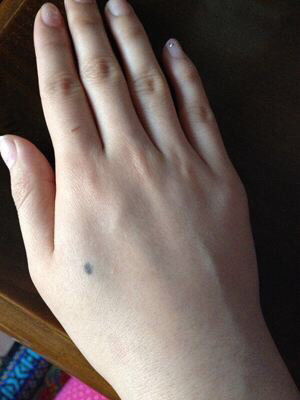 手背上有痣是不是好事?