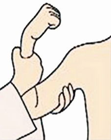 肌力和肌张力有什么区别