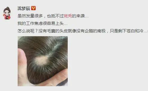 薅头发是什么意思?