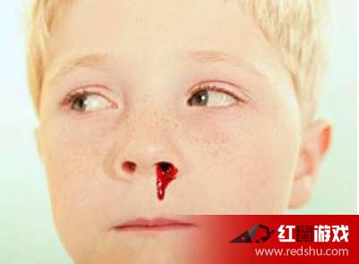 流鼻血 征兆 预示着什么