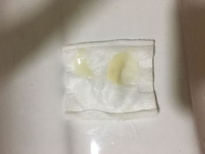 灌肤的正确步骤