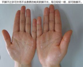 出手汗脚汗是什么原因?