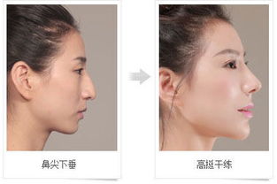 解析:鹰钩鼻子的男人面相好吗?