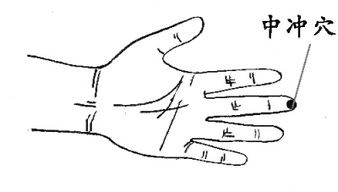 经络穴位,一日一学-中冲穴,对常见小毛病晕车、中暑很有效