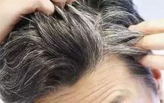 长白头发怎么调理好