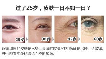 眼角纹去除的小妙招