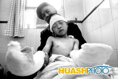 “怪鱼咬伤男孩3根手指”!凶猛鳄雀鳝现身江苏,是谁将其放到小区水池的