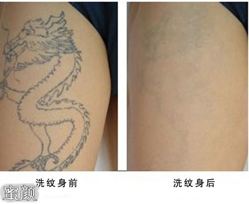 几次能洗掉纹身