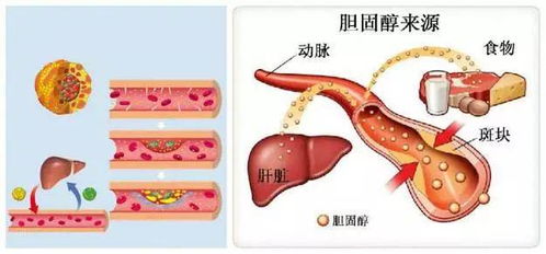 什么叫胆固醇?什么意思?