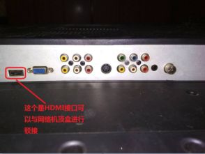 网络电视信号源选哪一个