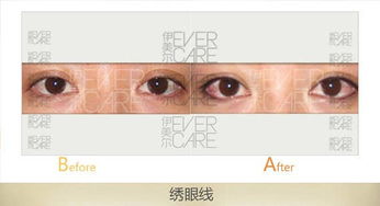美瞳线会伤到眼睛吗?