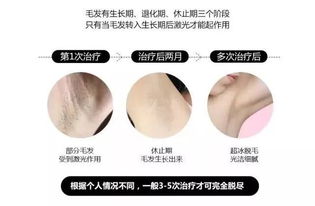 脱毛膏的原理