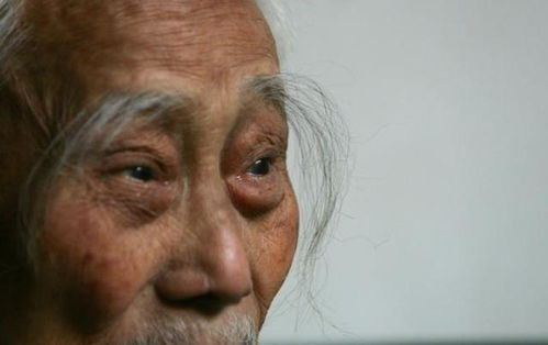 40岁长长寿眉怎么回事