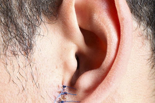 一个口字头一个王加耳朵旁念什么