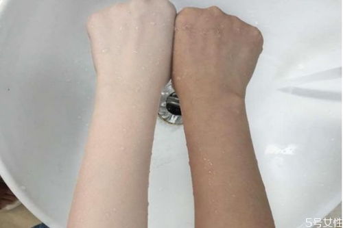 膝盖黑怎么美白