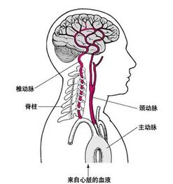 动脉硬化是什么意思