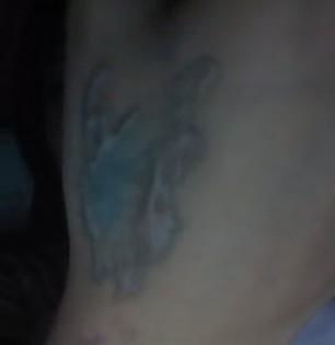 纹身怎么彻底清除呢?