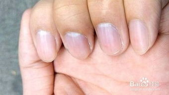 怎样才能让指甲更亮更健康?