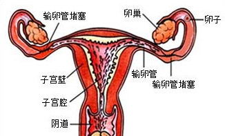 导致女性卵管堵塞的原因有哪些?