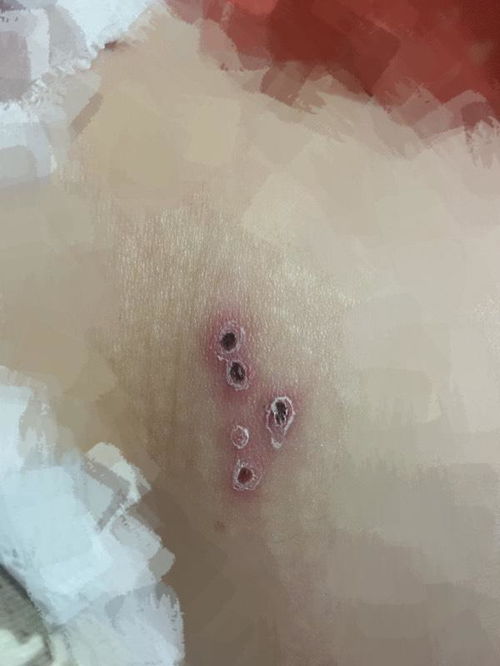 男人的腹股是哪里图片