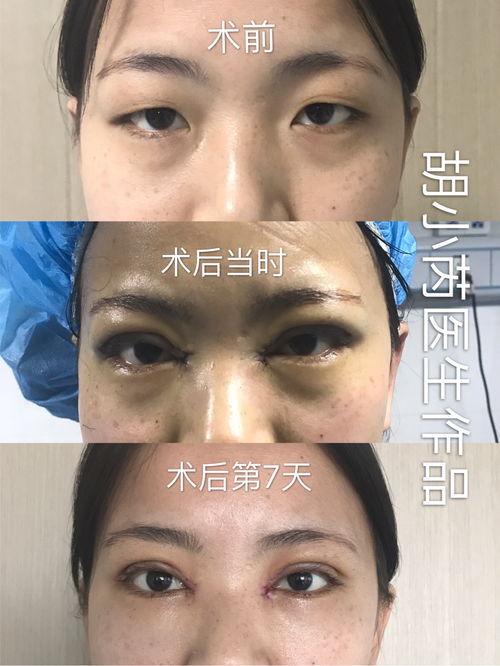 发现美的眼睛作文