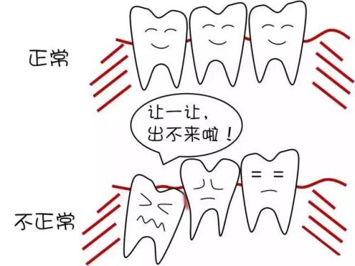 牙上有个洞,是该去补牙还是直接拔掉?