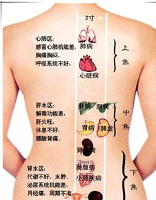 怎样背部刮痧